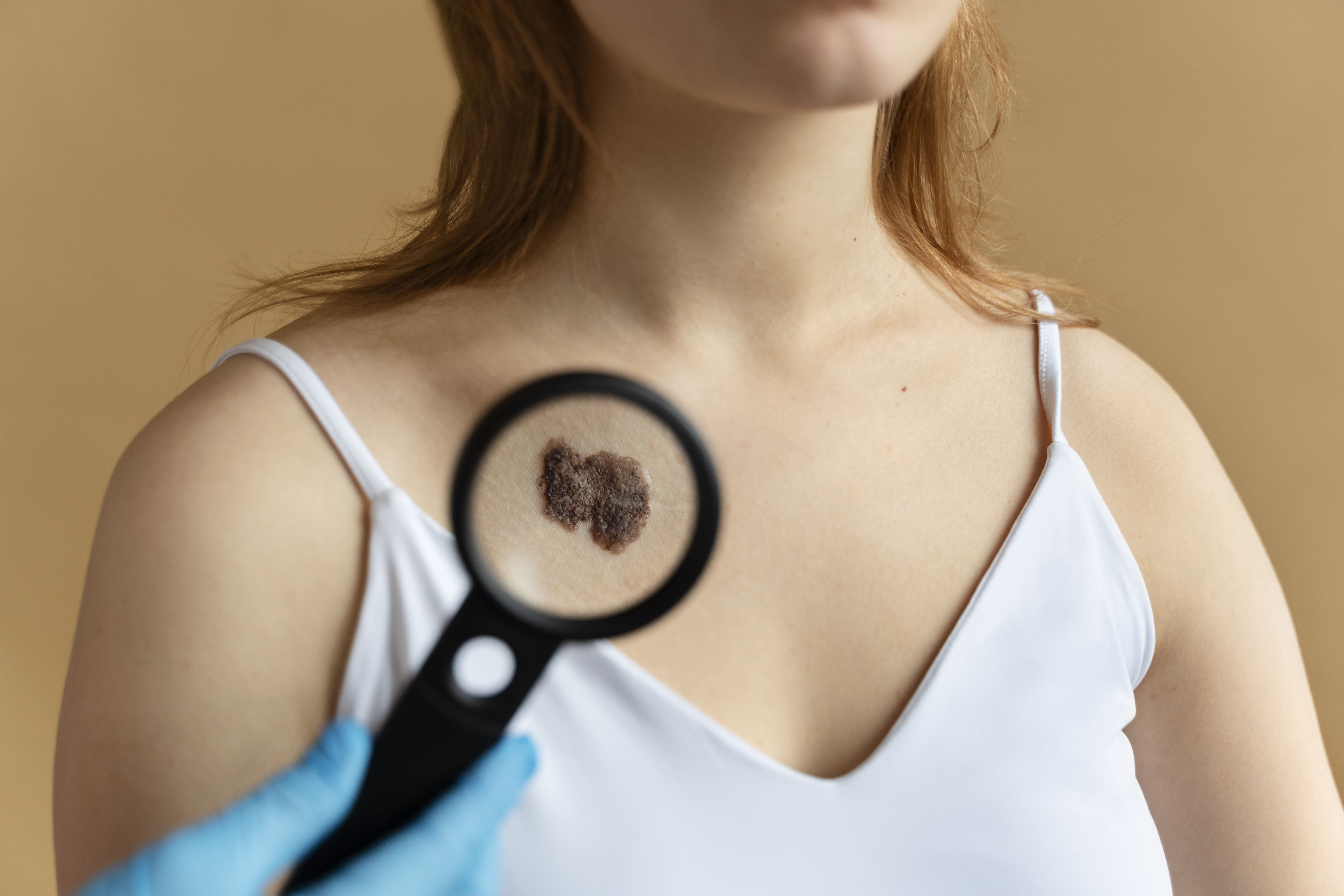 Skin cancer supportive care