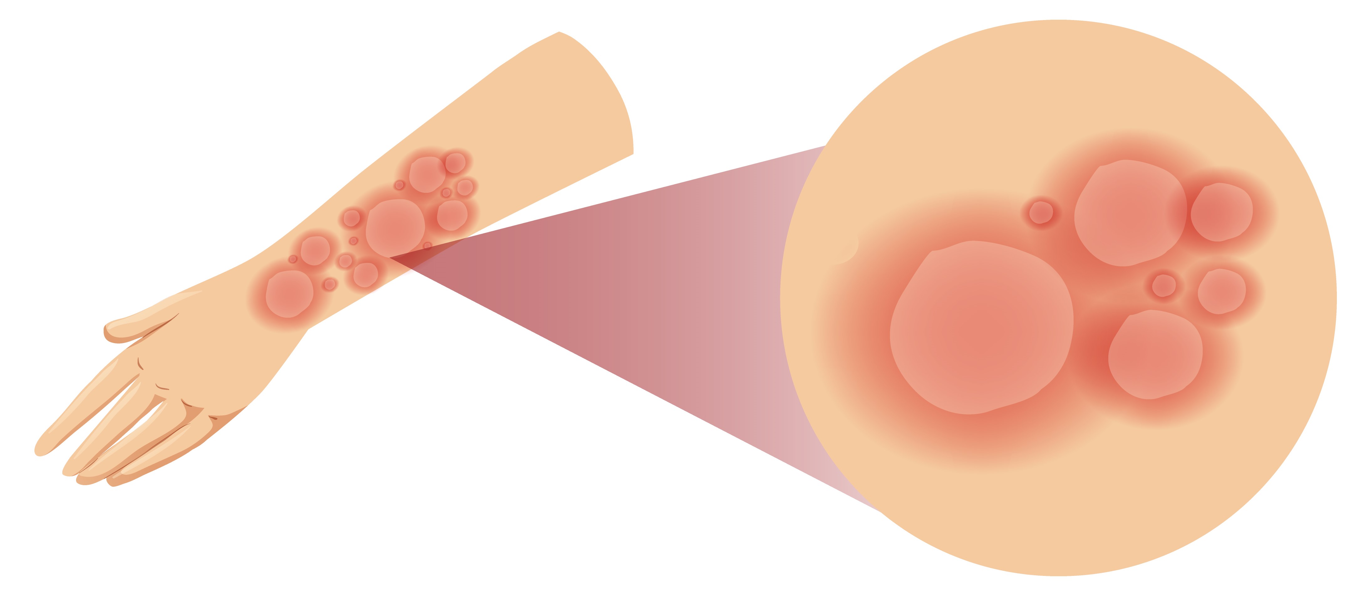 Ayurvedic skin treatment